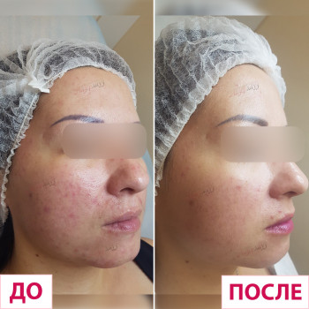 Лазерхауз, Бердянськ Фото - 20