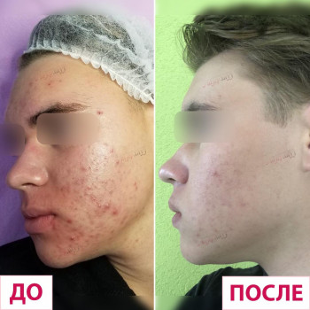 Лазерхауз, Бердянськ Фото - 21