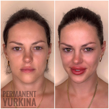 Межресничка и губы