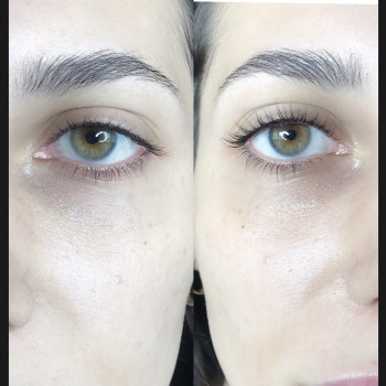 Ламинирование ресниц