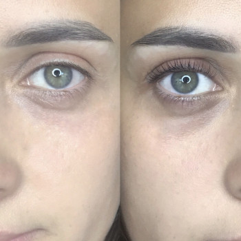 Ламинирование ресниц
                    Лешмейкер Светлана Поддубняк Київ