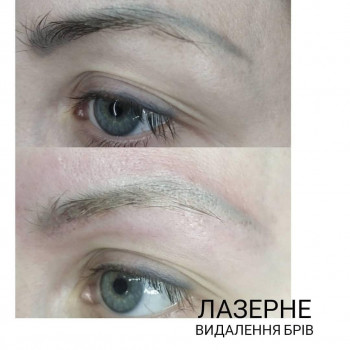 Аліна Обрезкова, Ивано-Франковск Фото - 29