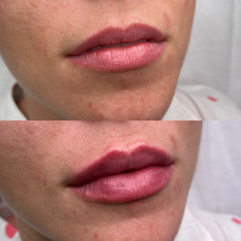 Анна Белошицкая , Черкассы Фото - 5