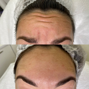 Анна Белошицкая , Черкассы Фото - 6