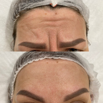 Анна Белошицкая , Черкассы Фото - 8