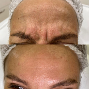 Анна Белошицкая , Черкассы Фото - 12