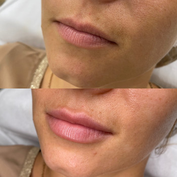 Анна Белошицкая , Черкассы Фото - 13