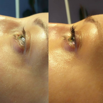 Ламинирование ресниц