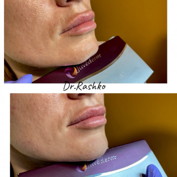 Артур Рашко, Луцьк Фото - 10