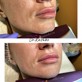 Артур Рашко, Луцьк Фото - 11