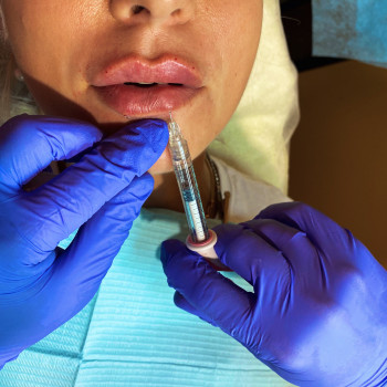 Артур Рашко, Луцьк Фото - 16