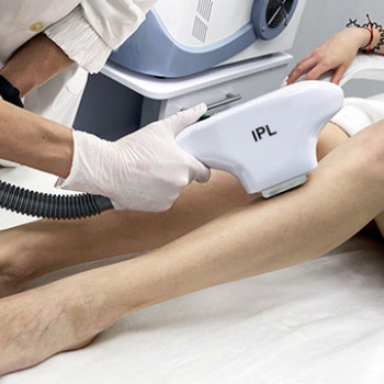 Лазерная эпиляция ног