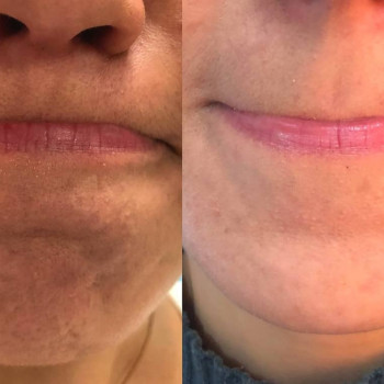 Виктория Николаевна Мозговая Мозгова, Винница Фото - 7