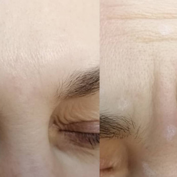 Виктория Николаевна Мозговая Мозгова, Винница Фото - 8