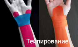 Тейпування зап'ястка Косметолог-эстетист Светлана Киев
