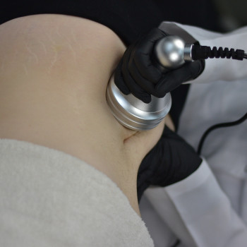 Кавитация
                    Косметолог Анна Викторовская Днепр