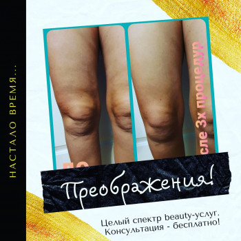 Сергій Савін, Запоріжжя Фото - 26