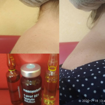 Юлия Матушкина, Харьков Фото - 7