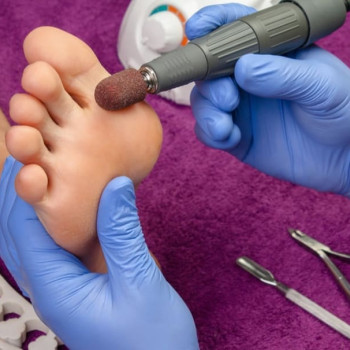 Венеция, Житомир Фото - 86