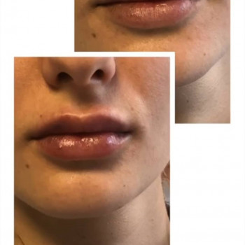 Контурная пластика
                    Медицинский центр Чотири Сезони Белая Церковь