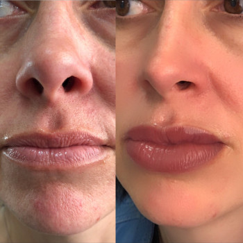 Перманентный макияж
                    Косметолог Евгения Романчук Киев