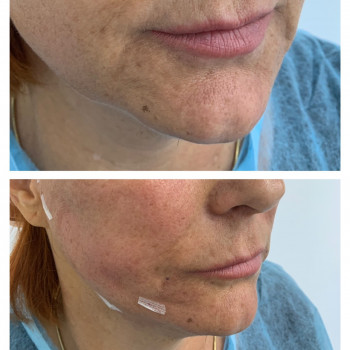 Нити Аптос
                    Косметолог Ирина Кривий Ріг