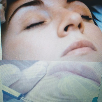 Механическая чистка лица
                    Косметолог Светлана Днепр