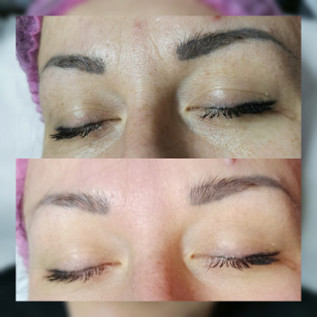 Пилинг ABR Holy Land
                    Врач-косметолог Наталия Сумы