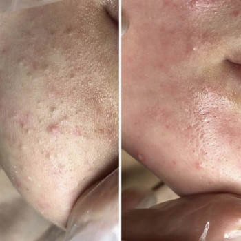 Екатерина Дмитриева, Київ Фото - 20