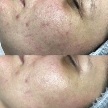 Екатерина Дмитриева, Київ Фото - 21