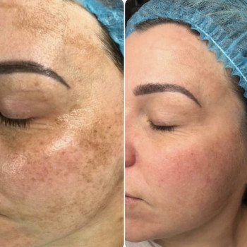 Екатерина Дмитриева, Київ Фото - 25