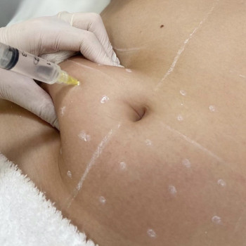 Екатерина Дмитриева, Київ Фото - 26