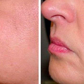 RF лифтинг
                    Косметолог Дарья Мариуполь