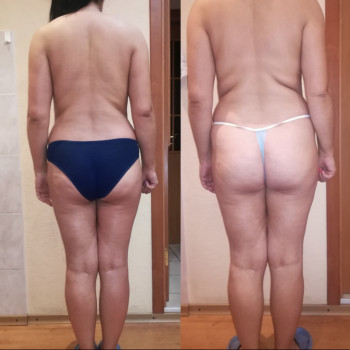 Массаж антицеллюлитный
                    Косметолог Дарья Маріуполь