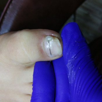 Кабинет помощи стопам PodoExpert, Харьков Фото - 7