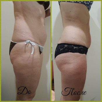 Татьяна , Одесса Фото - 6