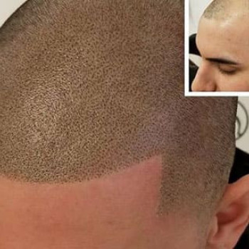 Татуировки любой сложности. Перекрытие шрамов
                    Тату мастер Александр Викторович Запорожье