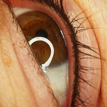 Перманентный макияж, татуаж. Перекрытие старого татуажа
                    Тату мастер Александр Викторович Запорожье