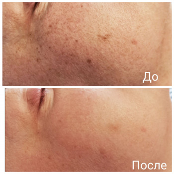 Марина Виталиевна , Винница Фото - 1