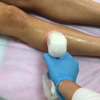 Лазердей (Lazerday), Львів Фото - 1