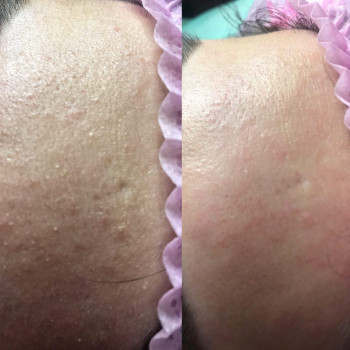 Лазердей (Lazerday), Львів Фото - 4