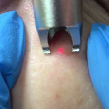 Лазердей (Lazerday), Львів Фото - 6