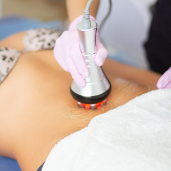 RF ліфтинг обличчя та тіла
                    Косметологічний центр Ідеальне Тіло Ужгород