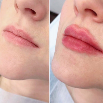 Катерина Колос, Київ Фото - 28