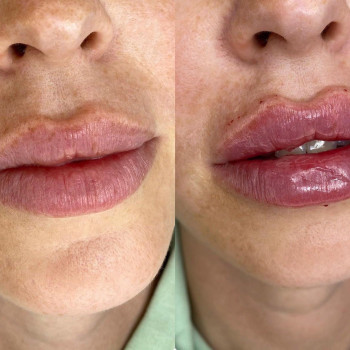 Катерина Колос, Київ Фото - 35