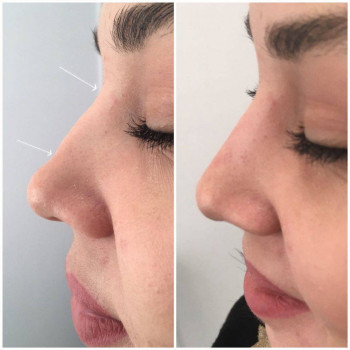 Катерина Колос, Київ Фото - 42