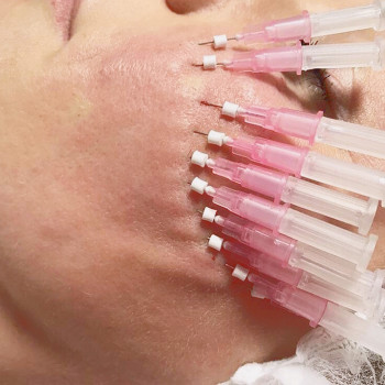 Катерина Колос, Київ Фото - 9