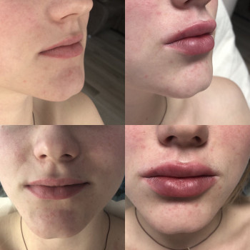 Катерина Колос, Київ Фото - 36