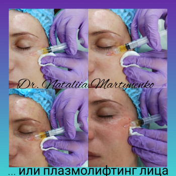 Наталия Мартыненко, Сумы Фото - 16