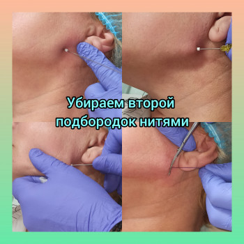 Наталия Мартыненко, Сумы Фото - 19